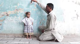 Due to a rare disease, the weight of a 9-year-old girl is only 8 kg and her height is only 2 feet.