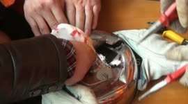 A man's finger gets stuck in the kettle