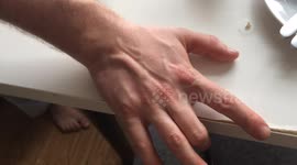 Dancing vein