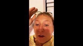 ‘I’m grateful I got cancer – I appreciate life so much more,’ says student diagnosed after tiny ‘DOTS’ appeared on skin.