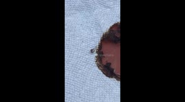 Tick Tick Boom! Dog owner gets shock when parasite explodes in front of him