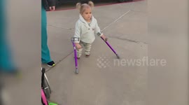 Five-year-old girl born with