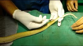 Moment surgeons remove large rose apple from cobra's stomach in India