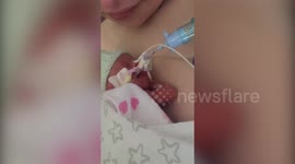 Mum's womb infection caused baby to be born at 23 weeks - weighing just 493g