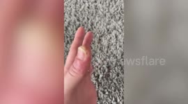 Mum can barely use her hands after developing a suspected allergy - to nail products