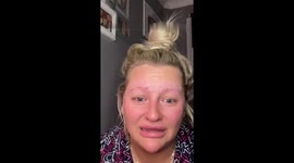 Lamination kit causes eyebrows to fall off!