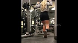 THIS YOUNG woman is embracing her EIGHTY-DEGREE ‘C’ curved spine after declining surgery to fix it even though doctors warned that it could eventually curve into her heart and KILL HER.