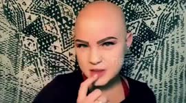MEET the inspirational teenager who is on a mission to motivate others to love themselves as they are after ditching bandanas and embracing the alopecia she’s had since she was just two years old.