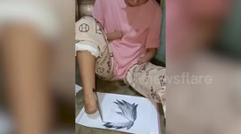 Inspiring artist, 16, with no hands or feet draws with pen taped to her leg stump