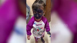 Little girl covers face in permanent marker before showing off artwork to mum