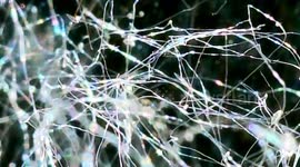 (Microscope view of pollen) Climate change is making our allergies worse