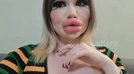 Woman with ‘world’s biggest lips’ hopes to find true love – but only if they accept her looks