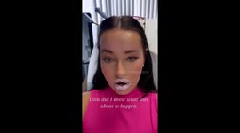 ‘Freebie lip filler made my lips DOUBLE in size – it hurt like hell' says woman 'left in tears' PART 3/3