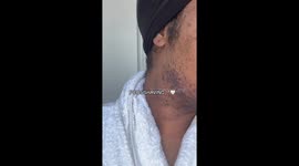 British woman, 28, who first grew beard aged 14 lets it grow for weeks – and doesn't care what trolls say