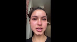 ‘I thought Hinge date leaned in to call me pretty – then he popped my PIMPLE’