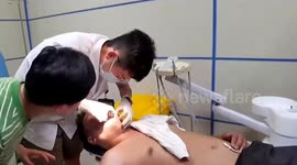 Not-so-bright idea: Doctor removes light bulb stuck in man's mouth in China