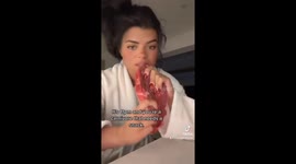 British woman bombarded with death threats because of raw meat diet advice
