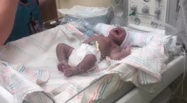 Nurse checking if New born baby have any abnormalities