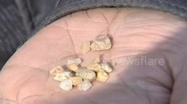 Woman in China's Shandong cries 'tears of stone'