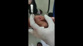 Finger stitching