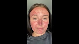 Woman who wanted to 'cry' when looking in mirror and called 'pizza face' by cruel bullies becomes social media star Part 1/3