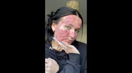 Woman who wanted to 'cry' when looking in mirror and called 'pizza face' by cruel bullies becomes social media star Part 2/3