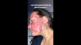 Woman who wanted to 'cry' when looking in mirror and called 'pizza face' by cruel bullies becomes social media star Part 3/3