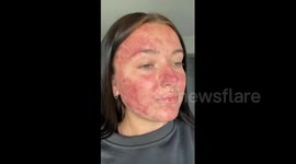 From 'pizza face' to social media star: go on the glowing journey with Yorkshire woman