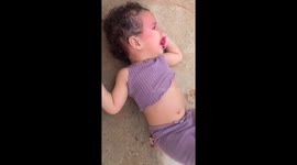 Twin Unbothered By Tantrum