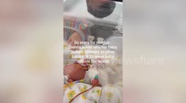 Baby born two months early and so small she had to wear doll's clothing has defied the odds