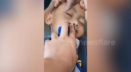 Parents remove tick stuck in child's eye in Malaysia