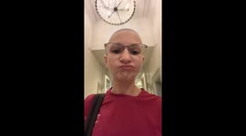 Teaching assistant, 23, with alopecia rocks shaved head at school to break stigma around hair loss Part 1/2