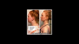 Woman shares incredible yet super simply routine to fix neck humps