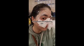 Woman rushed to hospital with lentils stuck in cheeks after pressure cooker explodes