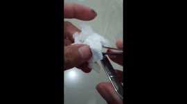 finger got hit by hammer and using used nail clipper cut let the blood out