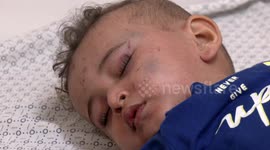 Palestinian wounded children at Shifa Hospital in Gaza City