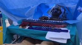 Music meets medicine: Indian Patient calmly plays piano during his own brain surgery