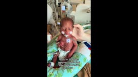 Mum shares shocking video of premature baby that weighs same as bag of sugar