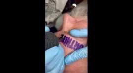 'Insane': Dad lets son 'tattoo FORTNITE' on his forehead' (Part 2)