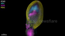 Researchers say first map of human limb development comparable to artist making a masterpiece