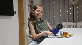 Girl with bionic arm looking forward to opening presents easily for first time