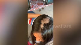 Thai woman loses clumps of hair from DIY hair straightening cream bought on TikTok