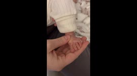Newborn baby has finger-like long toes *Insanely Rare Happening*