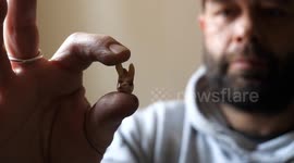 Dad pulls out tooth with a pair of pliers - after failing to get a dentist appointment
