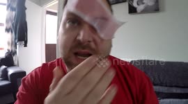Prankster girlfriend sticks wax strip on boyfriend's eyebrow