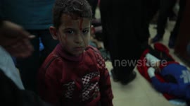Injured children treated after Israel strikes hit neighbourhood in Gaza