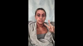 Mum with ‘oozing yellow’ eczema almost called off WEDDING DAY due to steroid withdrawal