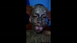 Body mod addict dubbed ‘demon’ with screw-in devil horns gets top lip REMOVED (part 2)