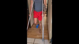 Copy cat! Feline mimics injured owner hobbling on crutches