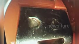 Doctors save man's life after he swallowed metal scissors and three cigarette lighters